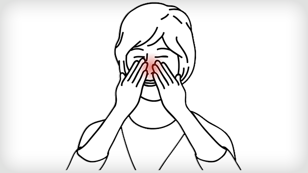 Emplacement du sinus ethmoidal mis en evidence a l’arriere du nez d’une femme